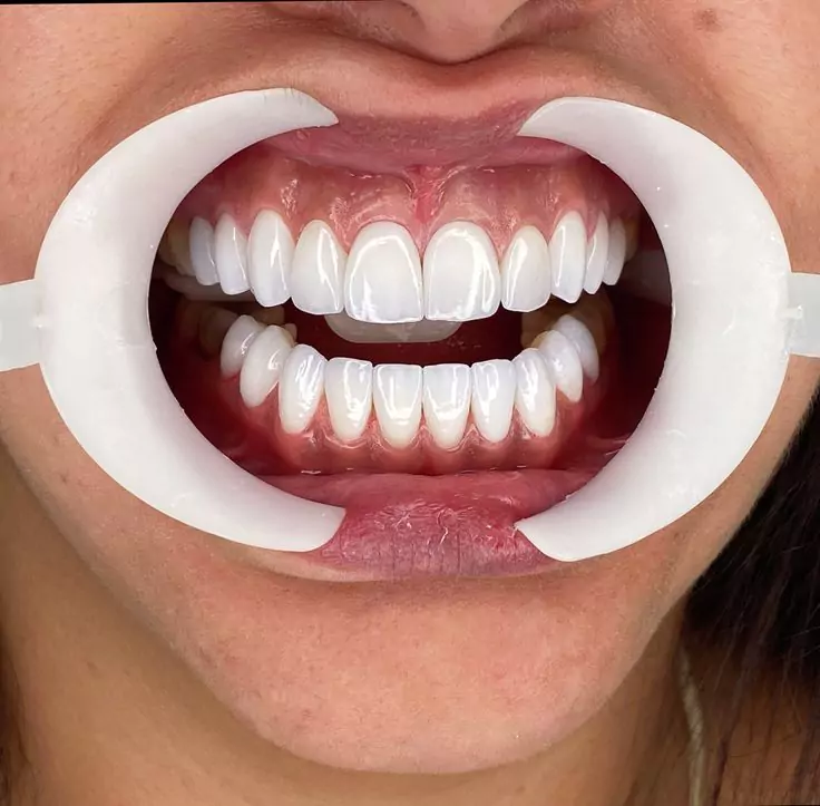 Ktheni Buzeqeshjen tuaj