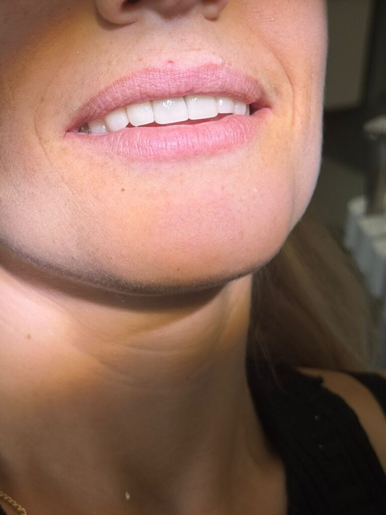 Klinika dentale me e mire ne durres