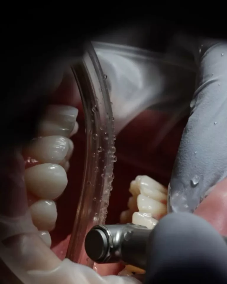 clinica dentale a durazzo