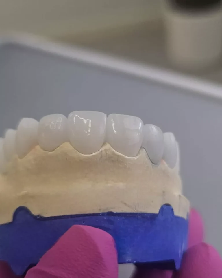 why albania fro dental tourism