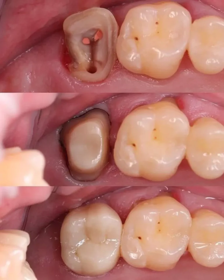 your solution for dental tourism in albania