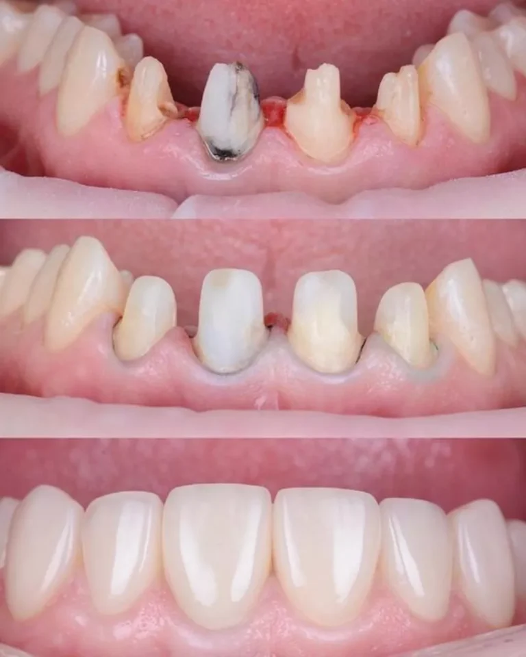 la tua soluzione per il turismo dentale durazzo