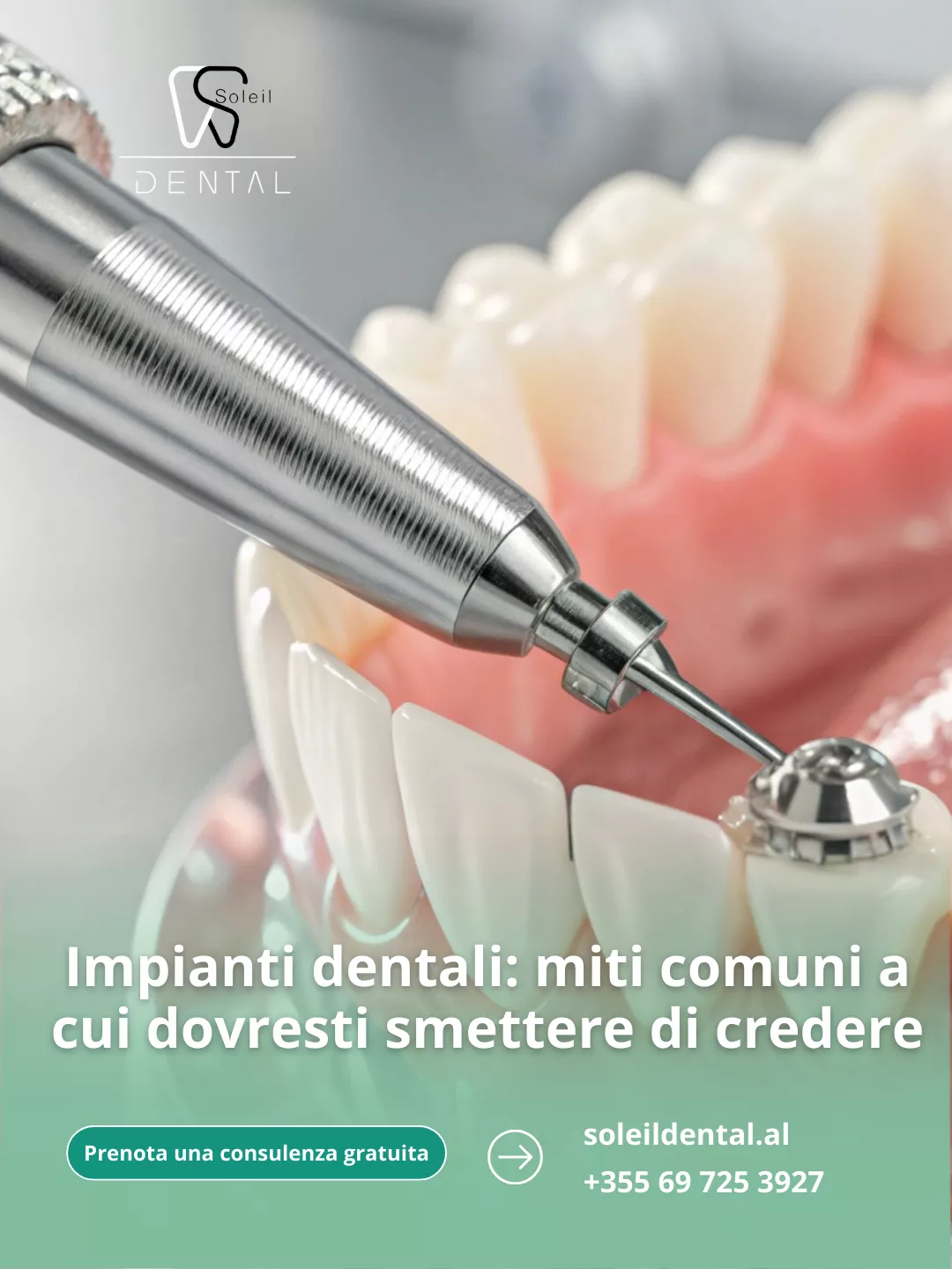 Impianti dentali: miti comuni a cui dovresti smettere di credere