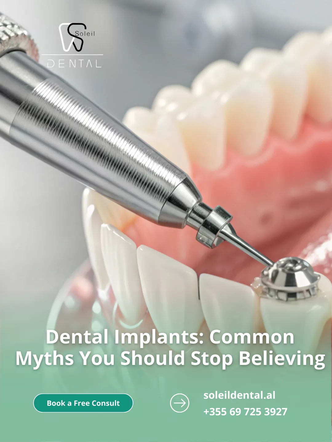 Dental Implants: Common Myths You Should Stop Believing