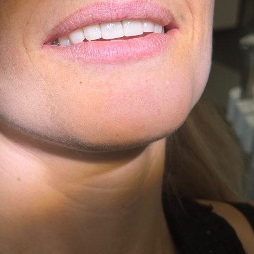 Klinika dentale me e mire ne durres