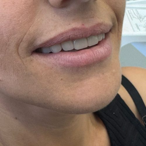 Soleil dental work (3)