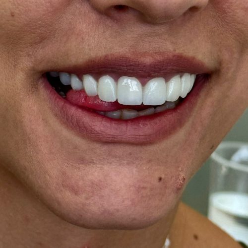 turiem dentar ne durres